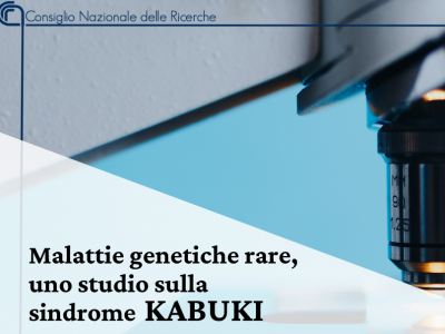 A Novel Finding On Kabuki Syndrome, A Rare Genetic Disease